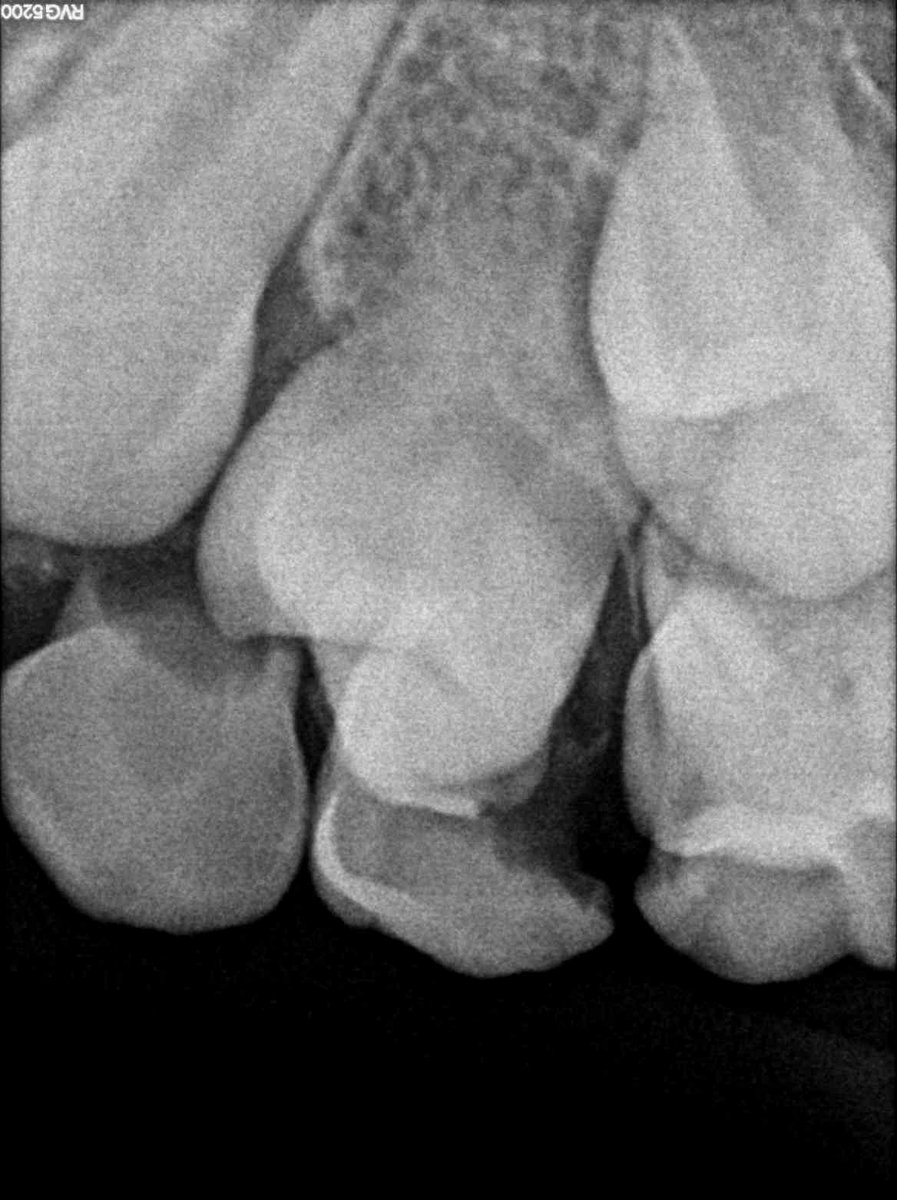 VitalTooth_'s tweet image. Take the kid to a #dentist at least every 6 months . 

#VitalTooth #dentaltips