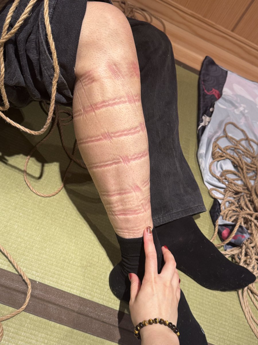 绳痕，被紧紧束缚过的证明