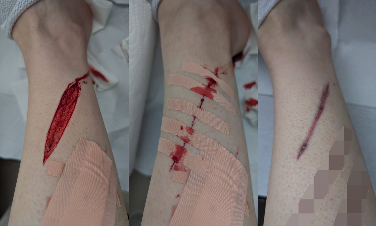 Tilia - Shedtwt tweet media