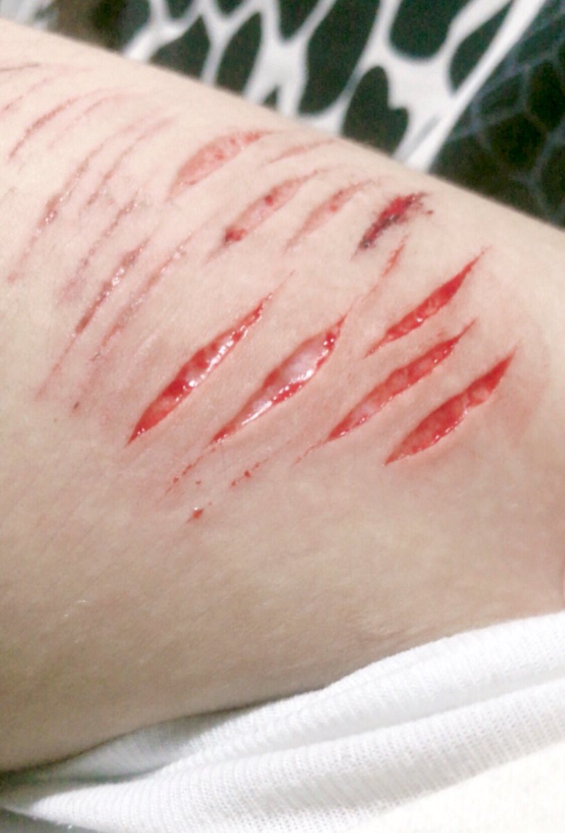 recov🎀 |pink of SHEDTWT .𖥔 ݁ ˖🐾˚. ᵎᵎ tweet media