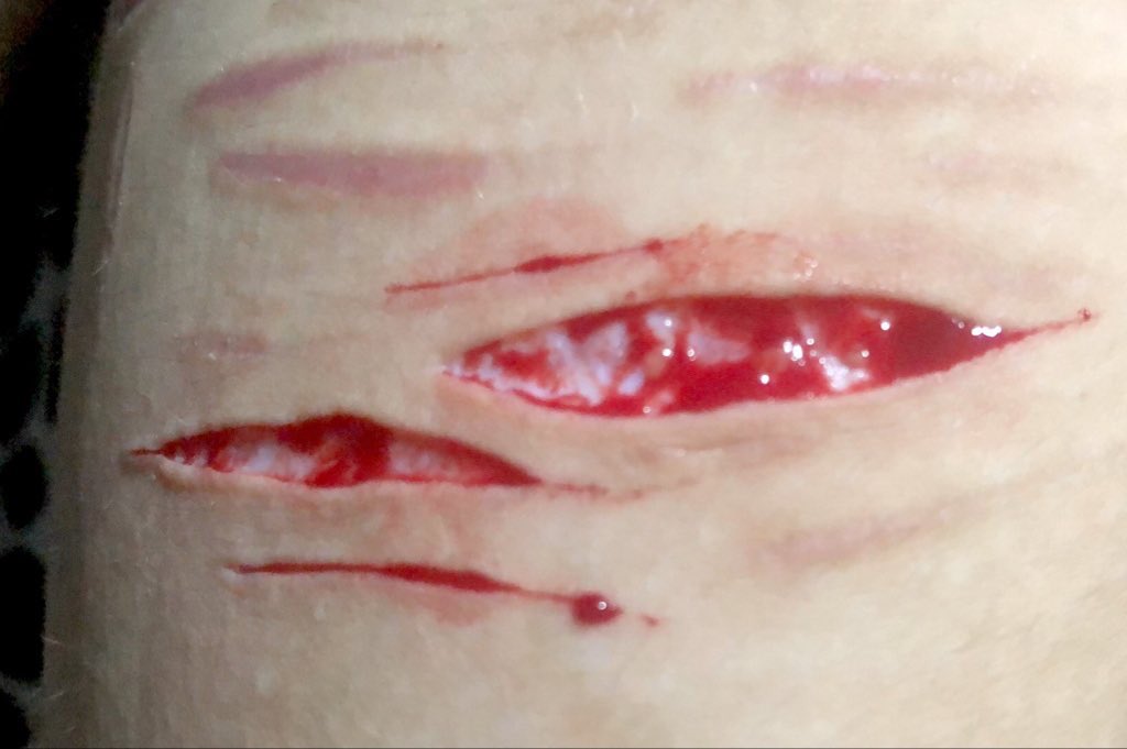 recov🎀 |pink of SHEDTWT .𖥔 ݁ ˖🐾˚. ᵎᵎ tweet media