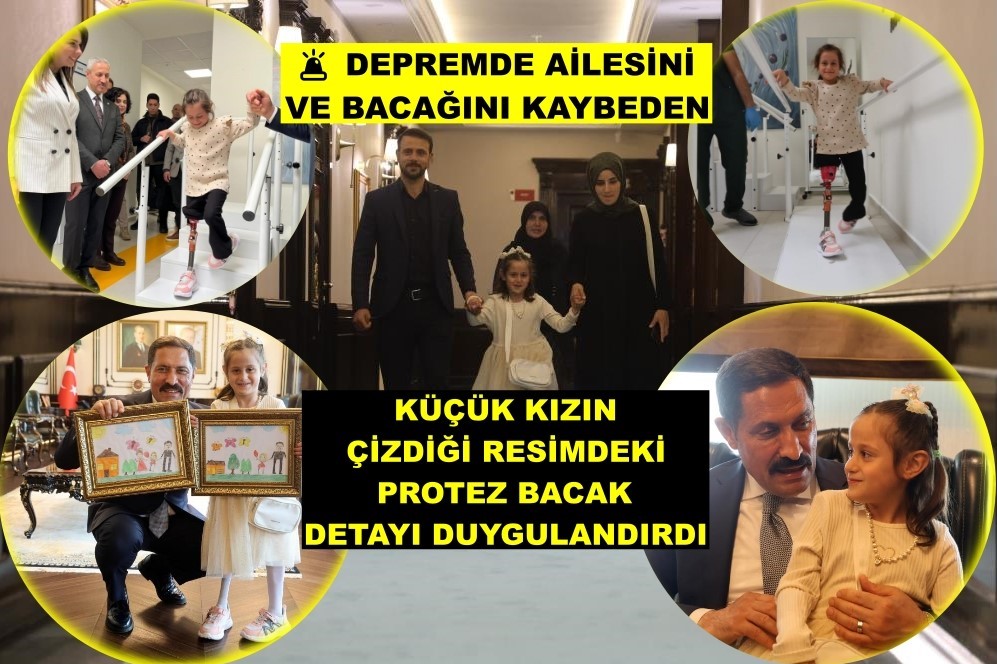 BeyzadeTV's tweet photo. 🚨 DEPREMDE AİLESİNİ VE BACAĞINI KAYBEDEN KÜÇÜK KIZIN ÇİZDİĞİ RESİMDEKİ PROTEZ BACAK DETAYI DUYGULANDIRDI
Hatay'da depremde annesini, babasını, 4 kardeşini ve sağ bacağını kaybeden ve kendi isteğine göre tasarlanan #protez bacağıyla yeniden yürümeye başlayan 7 yaşındaki kız, ilk adımlarını attığı anlara eşlik eden #Hatay Valisi Mustafa Masatlı'yı ziyaret etti.
#Depremzede kızın protez bacağına da yer verdiği resimleri görünce duygu dolu anlar yaşayan Vali Masatlı, resimleri ömrü boyunca hafızasında ve yüreğinde taşıyacağını söyledi.
Detaylar/Video 👇
https://t.co/kfTwQtVd8l