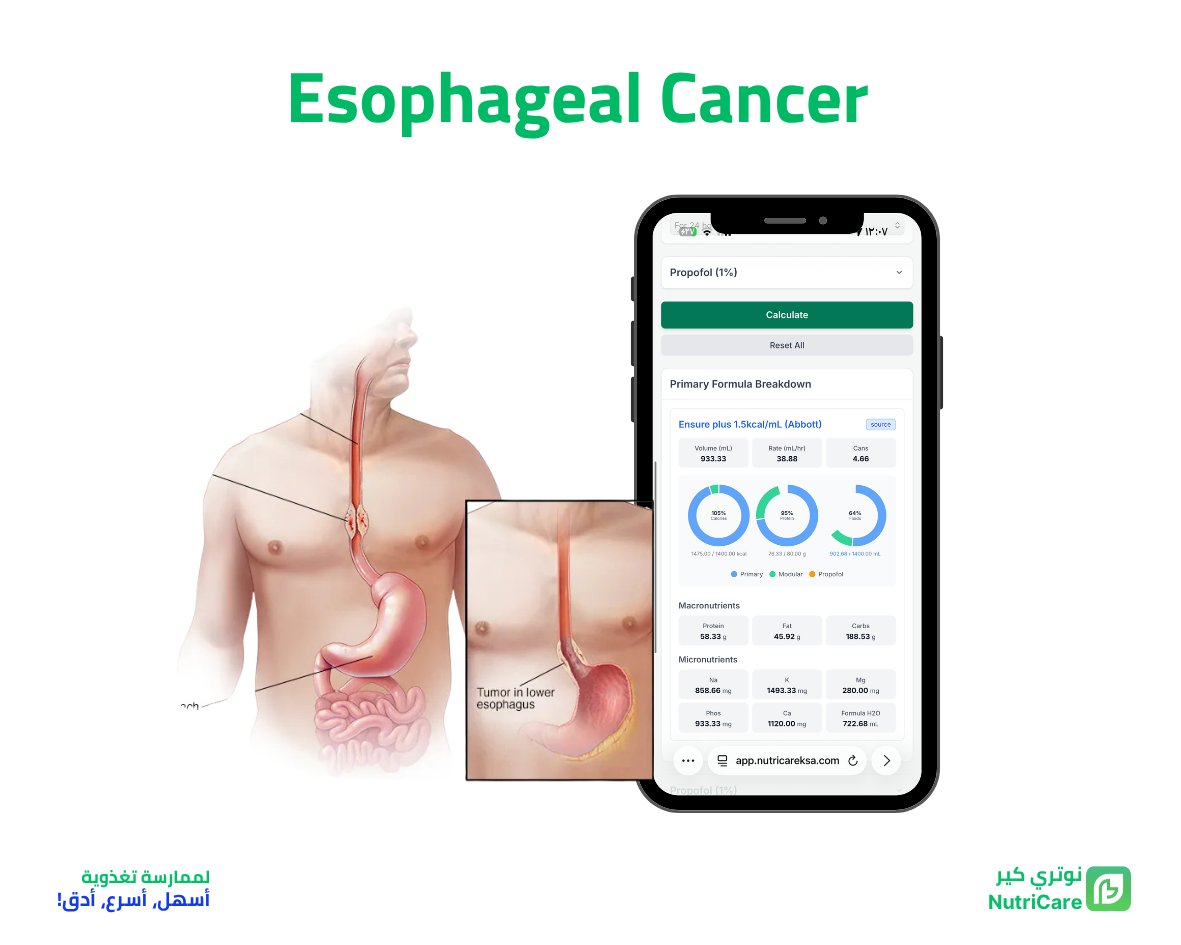 NutriCare | نـوتري كير 💚 tweet media