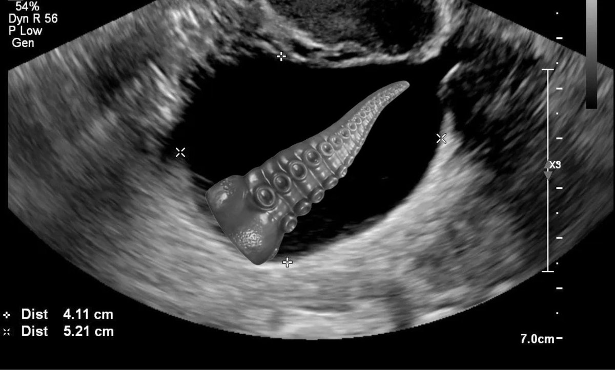 KokuDuende || 🌟 VSPICE 🌟 tweet media