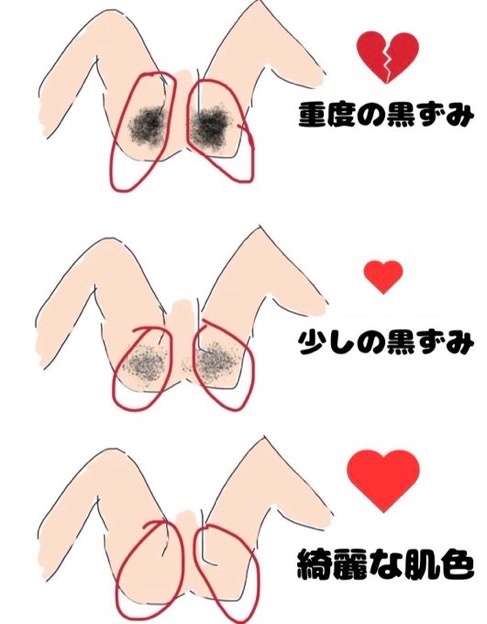 課金ちゃん tweet media