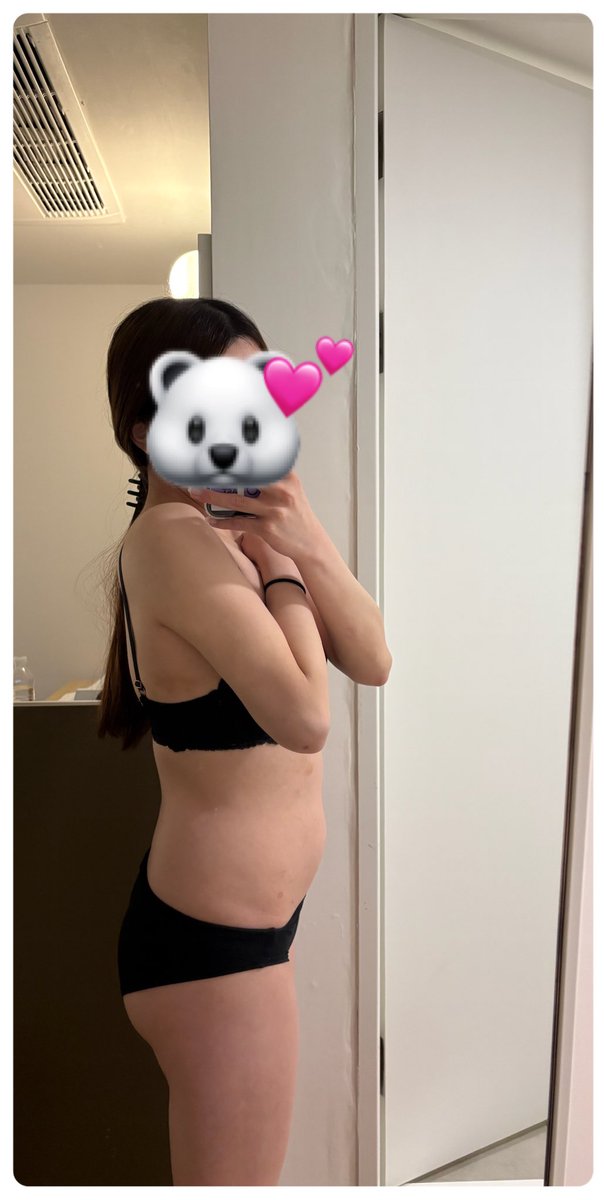 imn_mq's tweet photo. 術前（before） https://t.co/voTcp3x4HO