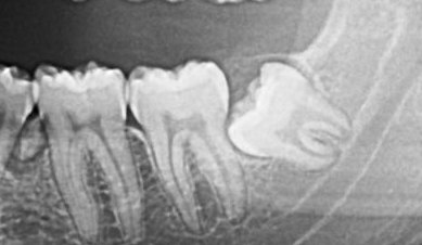 abian_01 tweet media