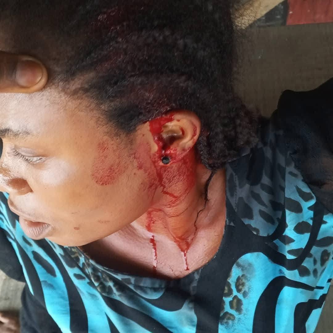 Annie▫️ tweet media