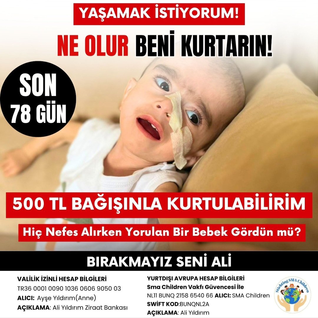feyzaempiress's tweet photo. BİR İNSANLIK SINAVIDIR
NE OLUR ALİ’NİN NEFESİNE ORTAK OLUR MUSUN?
Lütfen bu görsele sadece bakıp geçmeyin. Şu an ekrana bakan gözleriniz, SMA ile pençeleşen bir bebeğin son umut ışığı olabilir. Ali, henüz bir yaşında ama ömrünün tamamını hastane köşelerinde, soğuk cihazların gürültüsüyle geçirdi. O küçücük bedeni tam 5 kiloya düştü. Bir bebek büyürken ağırlaşır, Ali ise her geçen gün biraz daha hafifliyor, biraz daha aramızdan çekiliyor.
ZAMANIMIZ DARALIYOR, ALİ ERİYOR!
Valilik iznimizin bitmesine sadece 78 gün kaldı. Bu süre bittiğinde Ali için “keşke” demek kimseyi kurtarmayacak. Ali’nin ciğerleri sürekli doluyor; günde iki kez yapılan o ağır öksürtme seanslarında attığı çığlıklar, bir annenin yüreğini her gün bin kez parçalıyor. Babası bugün yine inşaatın tozunda, toprağında Ali yaşasın diye alın teri döktü. Ama bir babanın emeği, Ali’yi o karanlık tünelden tek başına çıkarmaya yetmiyor. LÜTFEN ALİNİN SESİ OLUN
#perşembe
#millitakım