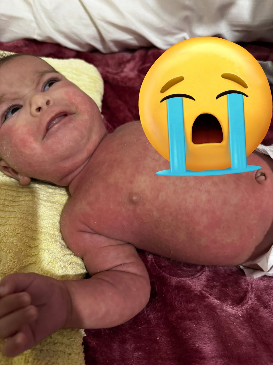 Dr.SAEB_FROM_GAZA tweet media