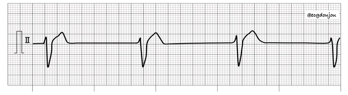 心電図道場 tweet media