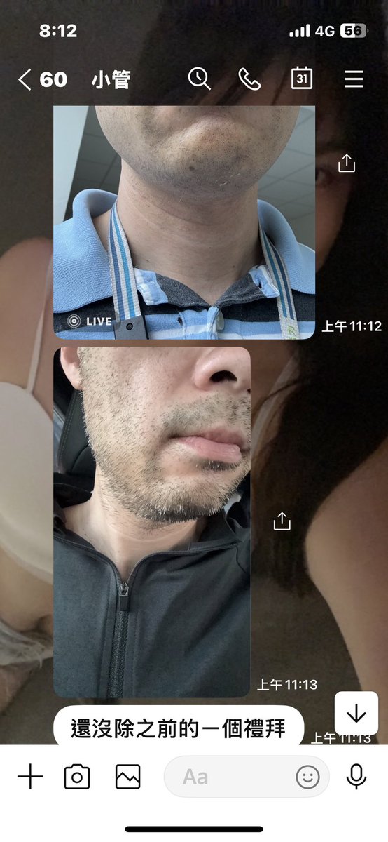 xioy32430's tweet photo. 好久沒發工作文💼
#一週起跳不用刮鬍子🪒 

鬍子🧔‍♂️聽說是眾多男性的困擾
尤其是這種濃密的落腮鬍🧔

每天都要刮 又容易刮到毛囊炎
但……來找小魚 幫您解決煩惱😣

熱蠟除毛 咻咻咻～除的乾乾淨淨
顧客反饋「已經一週沒刮鬍子」
也還沒長出來，非常開心🥳

限時優惠$1300
➕line:0976012352 https://t.co/Mc2m9WGxnc