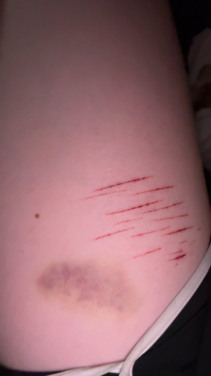 🩻 WHiTAKER OF SHEDTWT 🩺 tweet media