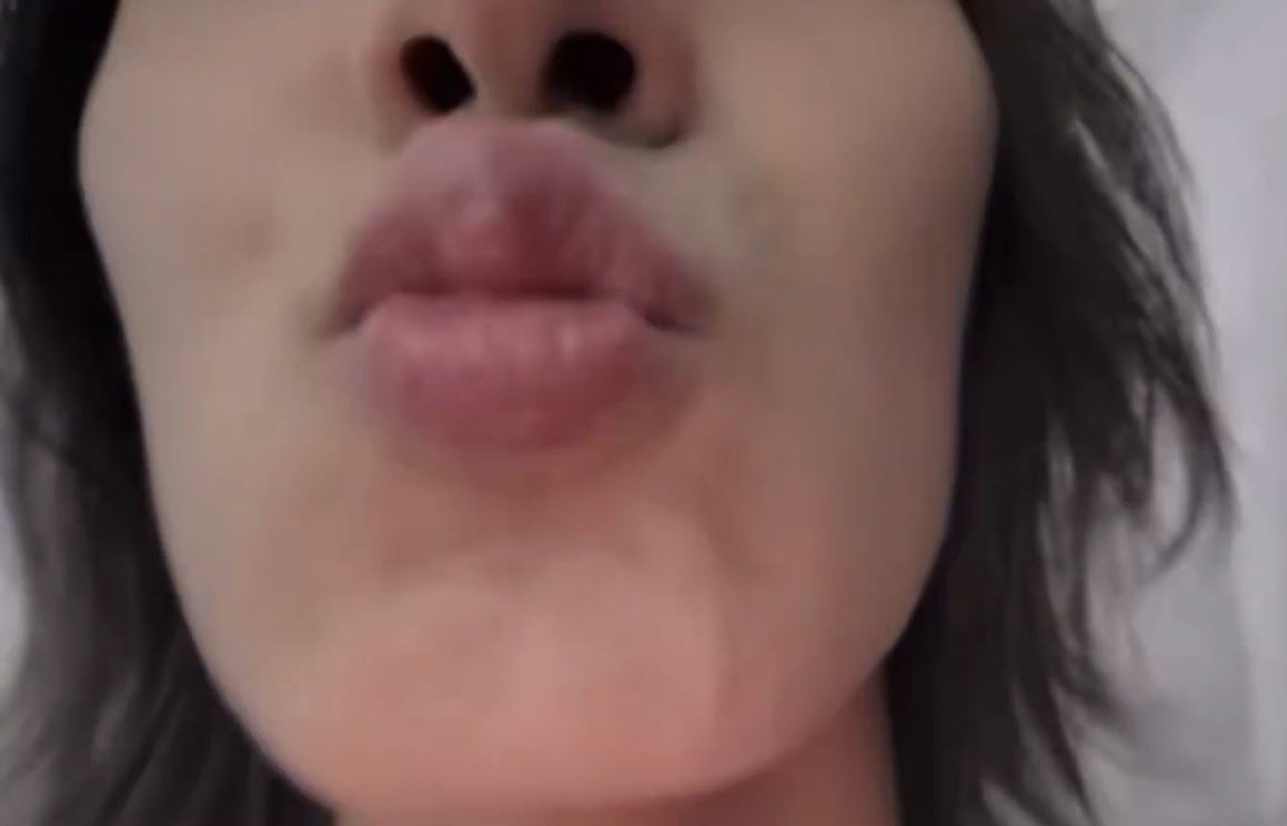 이옹쭈 tweet media