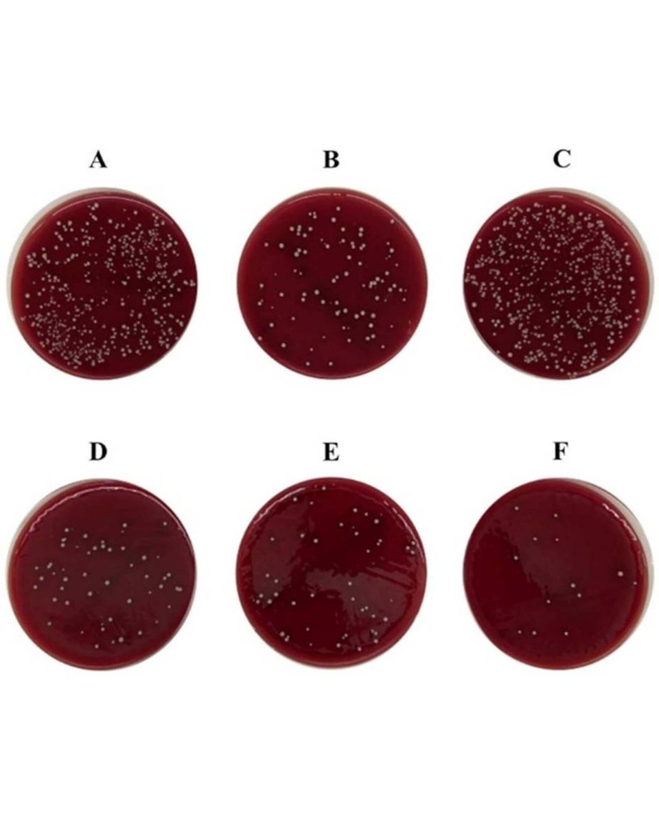 BoneJointRes's tweet image. Povidone-iodine irrigation significantly reduces both positivity rates and bacterial loads of common pathogens, particularly coagulase-negative staphylococci.

#BJR #Shoulder #Arthroplasty #Infection

ow.ly/lxCs50YzGmM