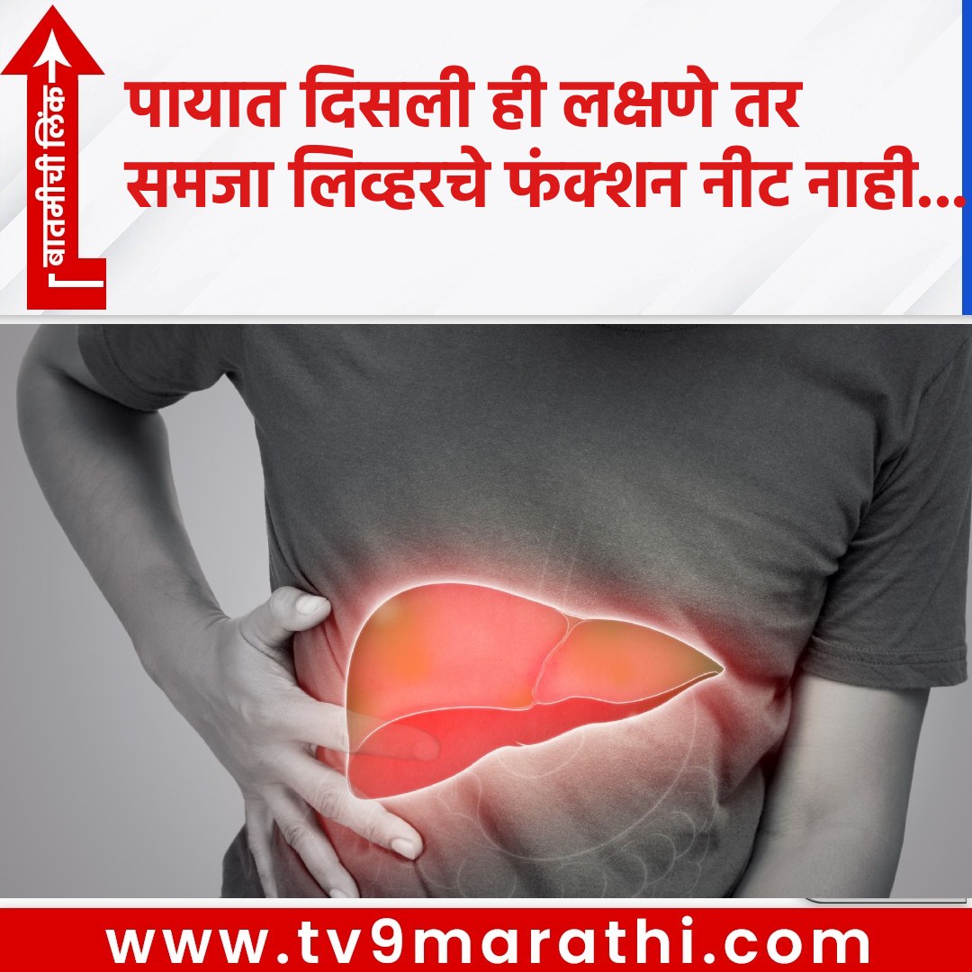TV9Marathi's tweet photo. पायात दिसली ही लक्षणे तर समजा लिव्हरचे फंक्शन नीट नाही...
https://t.co/ymocPYjooo
#lifestyle #lifestylenews #liver #liverfunction #LiverCirrhosis #ItchySkin #Legs #Health #Digestion #HormonalBalance #Immunity https://t.co/fNaRl0Co93
