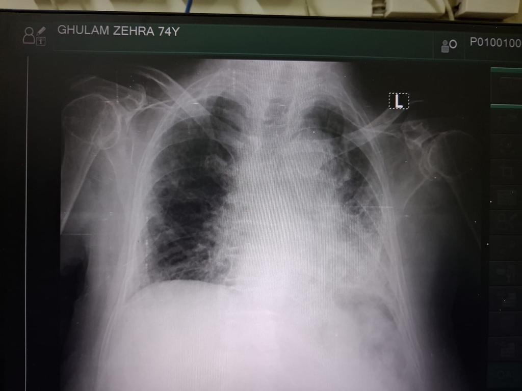 Sajid Hussain Shuqran tweet media