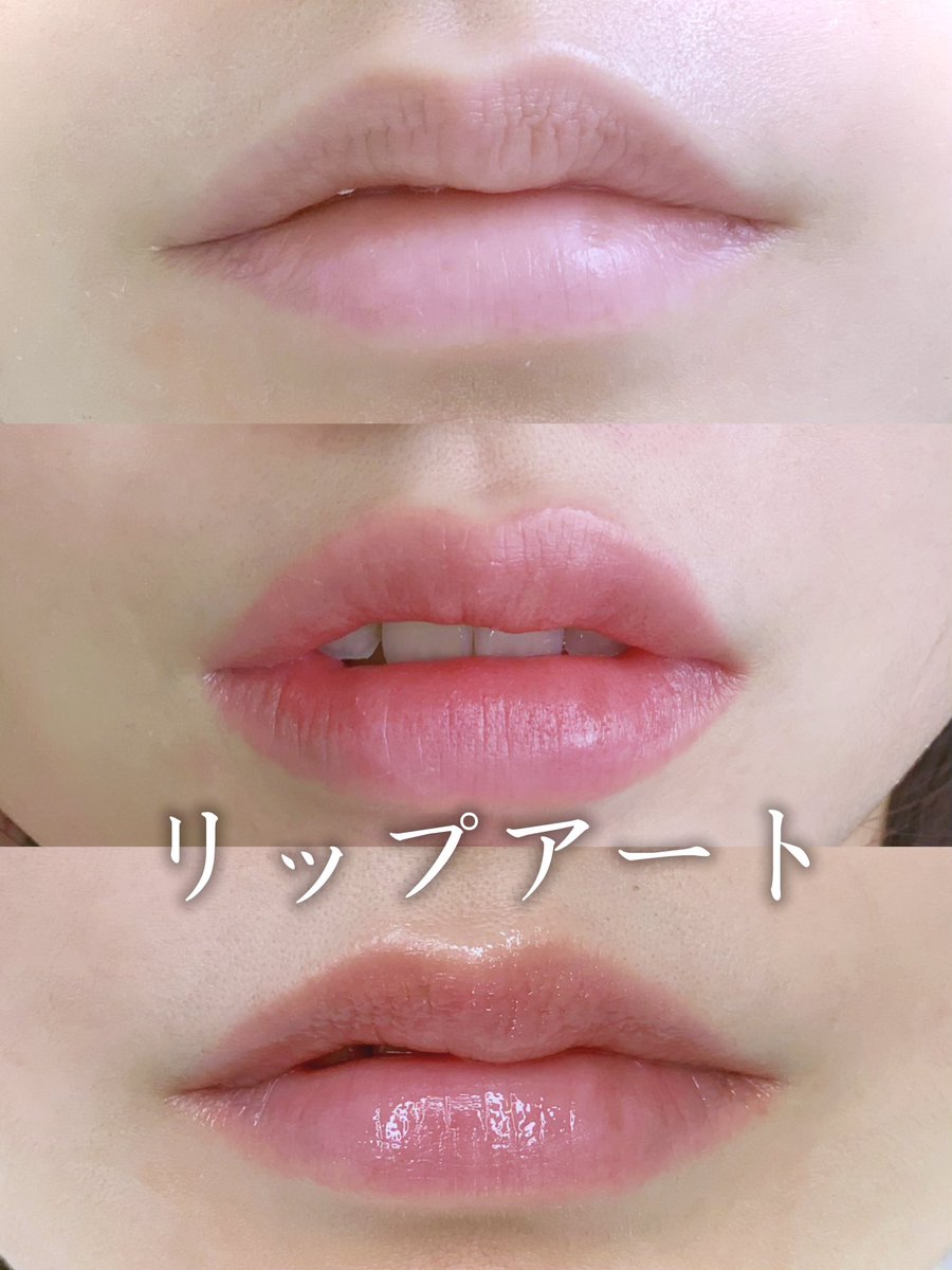 ソウル皮膚科🩵リー・アンド・クル tweet media