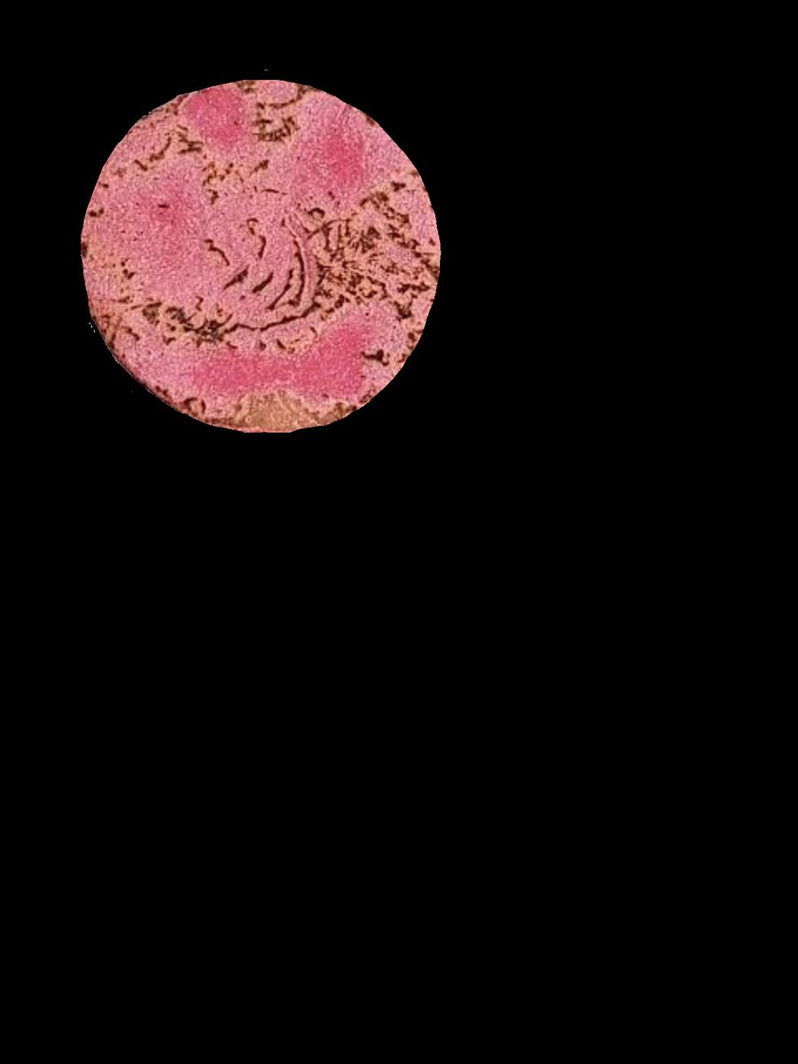 ✨❤️‍🔥𝖅a҉𝖗𝖙𝖑𝖎𝖈𝖍𝖊𝖀𝖓𝖇𝖊𝖖𝖚𝖊𝖒𝖊 ❤️‍🔥✨ tweet media