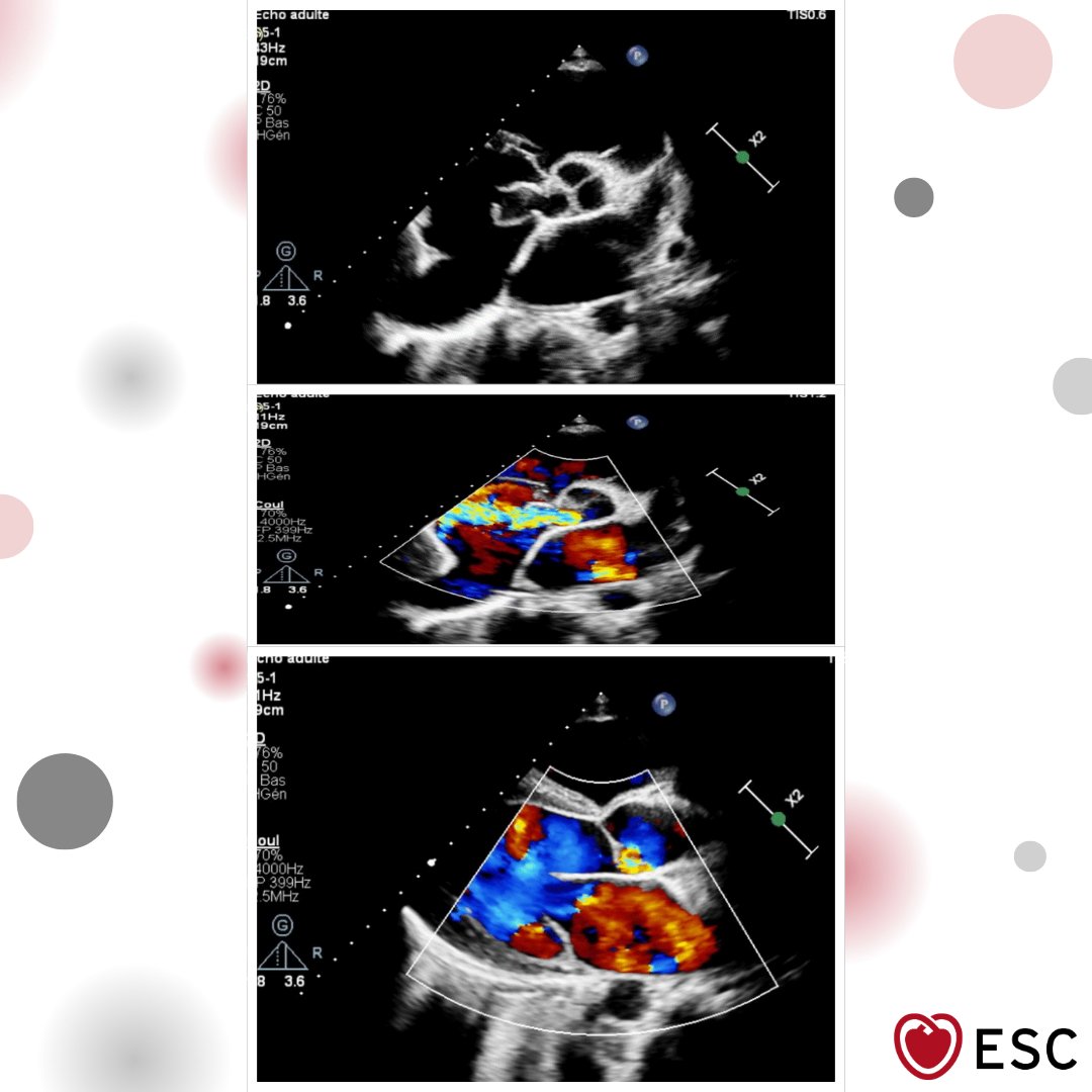 European Society of Cardiology tweet media