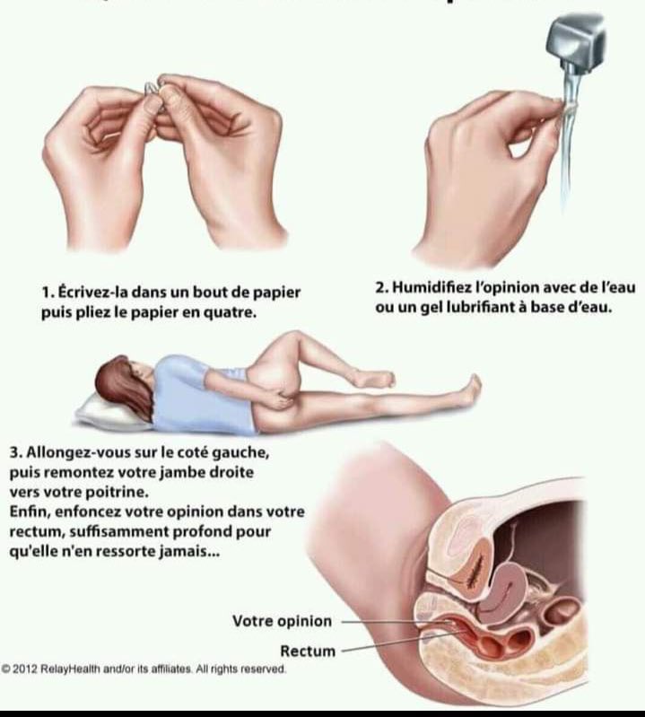 YA LOLO🇨🇩 tweet media