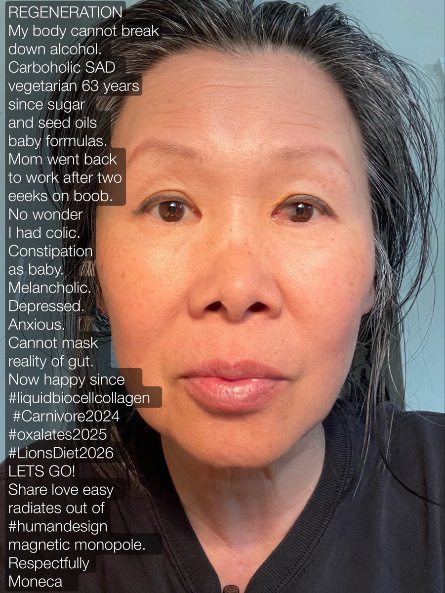CollagenBabe's tweet photo. #REGENERATION 
CURIOUS ABOUT #COLLAGEN 
#liquidbiocellcollagen2012  #Carnivore2024 #oxalates2025 #LionsDiet2026 
WATCH ME REGENERATE. 
#65YOBoomer #ConcussionRecovery   
#15Concussions Oct1, 2024.  
Respectfully Moneca #CollagenBabe  #Biohacker   #FutureGoPlayer  🙏🧠❤️🥩🇨🇦✨ https://t.co/yNO9LO9i9o