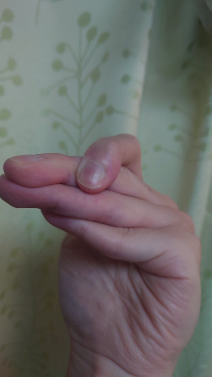 やったような記憶💭

#指関節柔らかいです
#シンラジオ