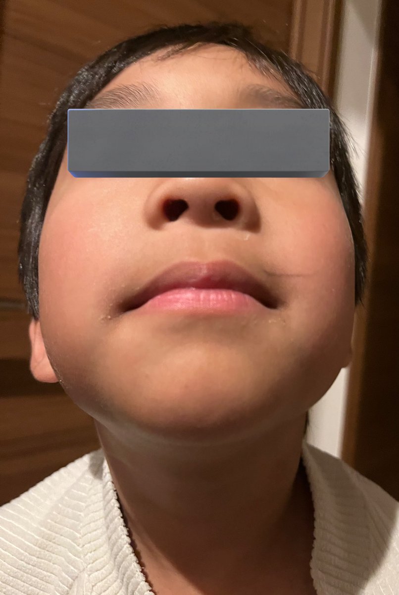 すけすけ ちよこ tweet media