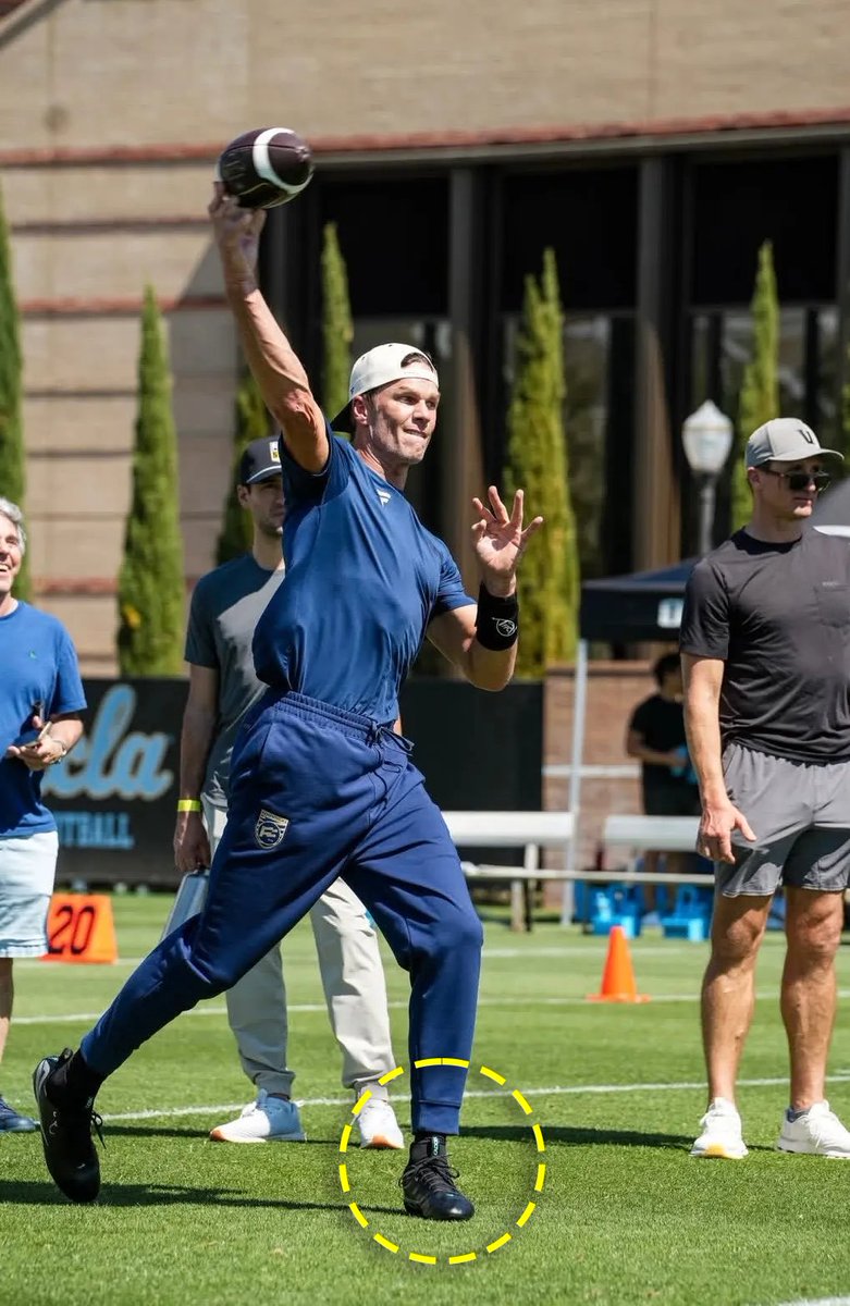 These are the most high-tech cleats ever created, and they could help prevent one of the most common injuries in all of sports… 

Let me explain.

1/6