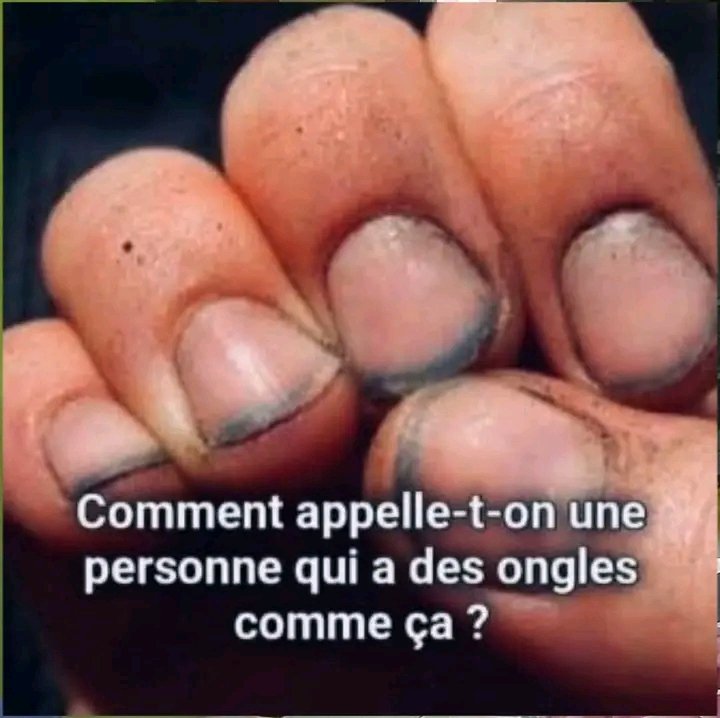 Jacob Shukuru tweet media