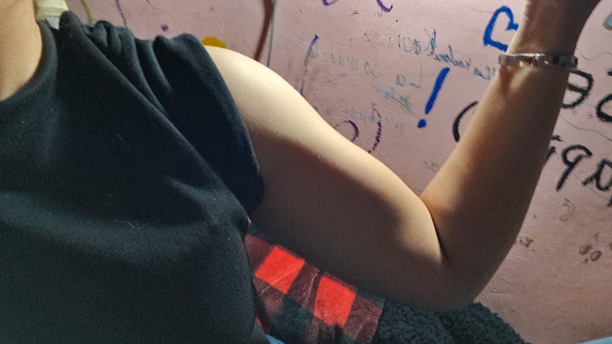 Lóbulo frontal en desarollo tweet media