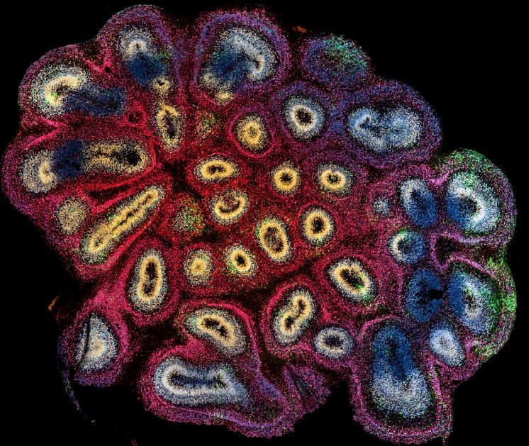 pragmaticmom's tweet image. Why is autism so much more common in males?
Harvard Ph.D. probes genetic underpinnings of risk disparity. buff.ly/nsCtB9o via @harvard #autism #AutismAcceptanceMonth