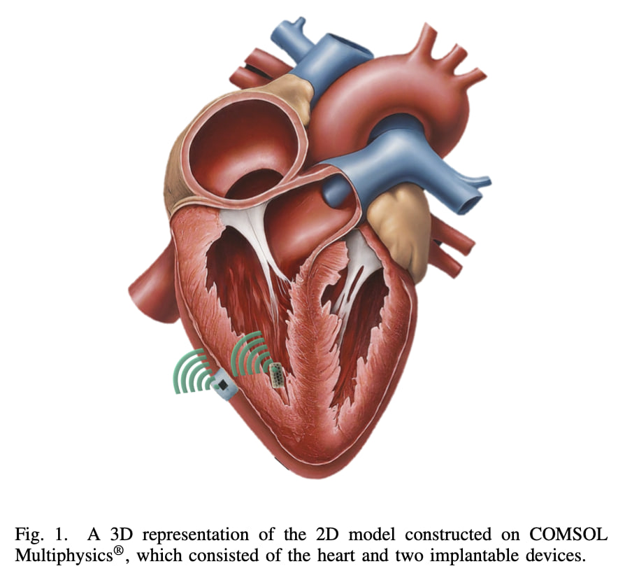 CorinneNokel's tweet image. Remote Patient Monitoring 

Wireless 'leadless' Pacemakers 

#Medtronic Micra 

Josep Miquel Jornet

Intrabody #THz Communication

Cardiac Healthcare 

medtronic.com/content/dam/me…