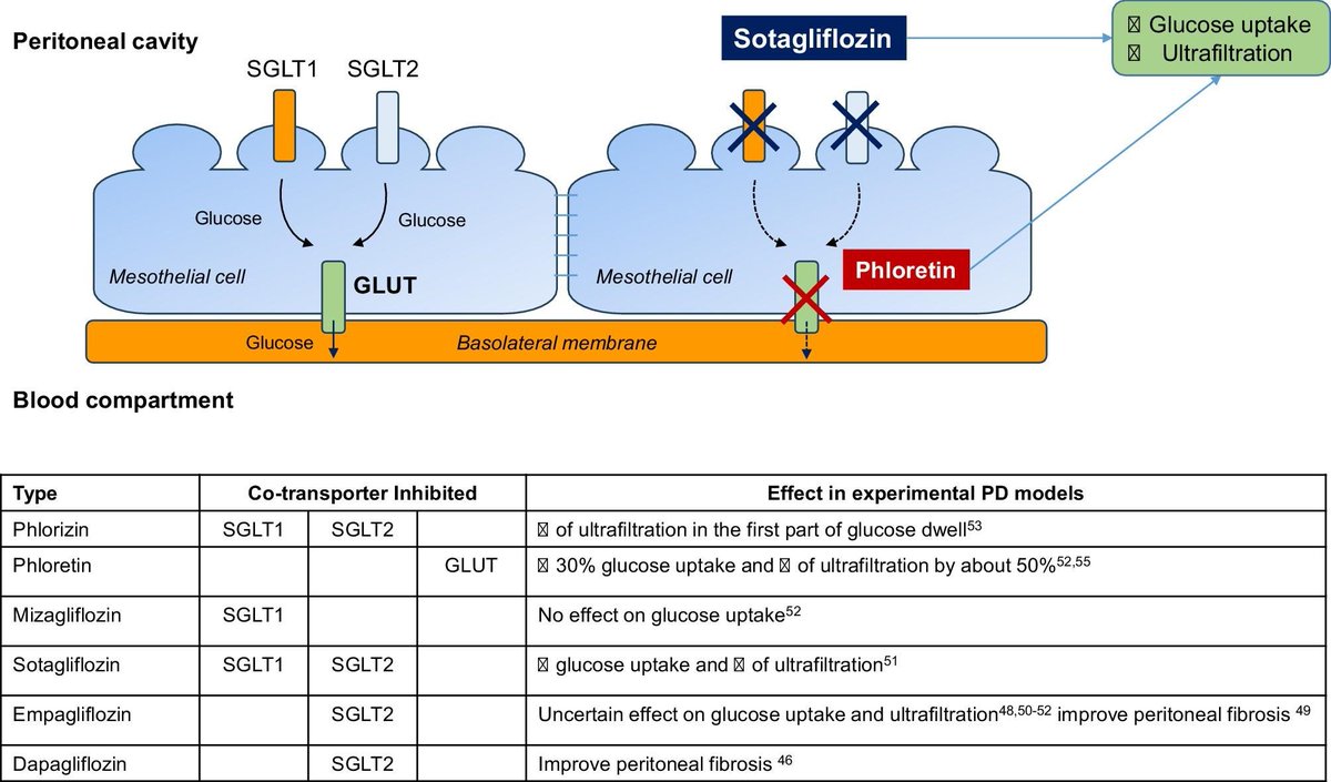 CKJsocial's tweet photo. SGLT2 inhibitors in hemodialysis or peritoneal dialysis patients: rationale and state-of-the art

https://t.co/gcfaOAsQHS https://t.co/xpRrPXrhEN