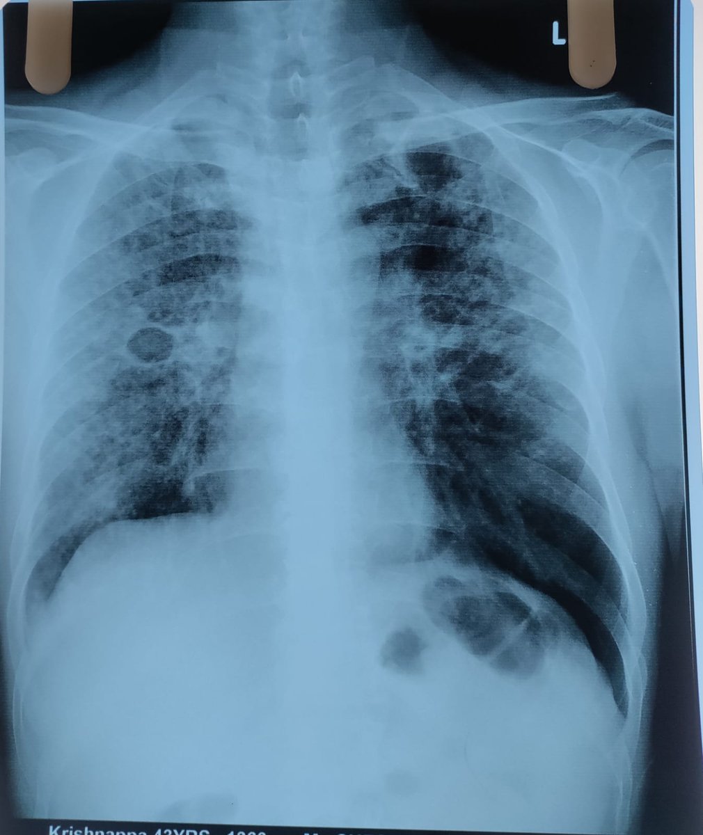 DrShivaಅಣ್ಣಾ tweet media