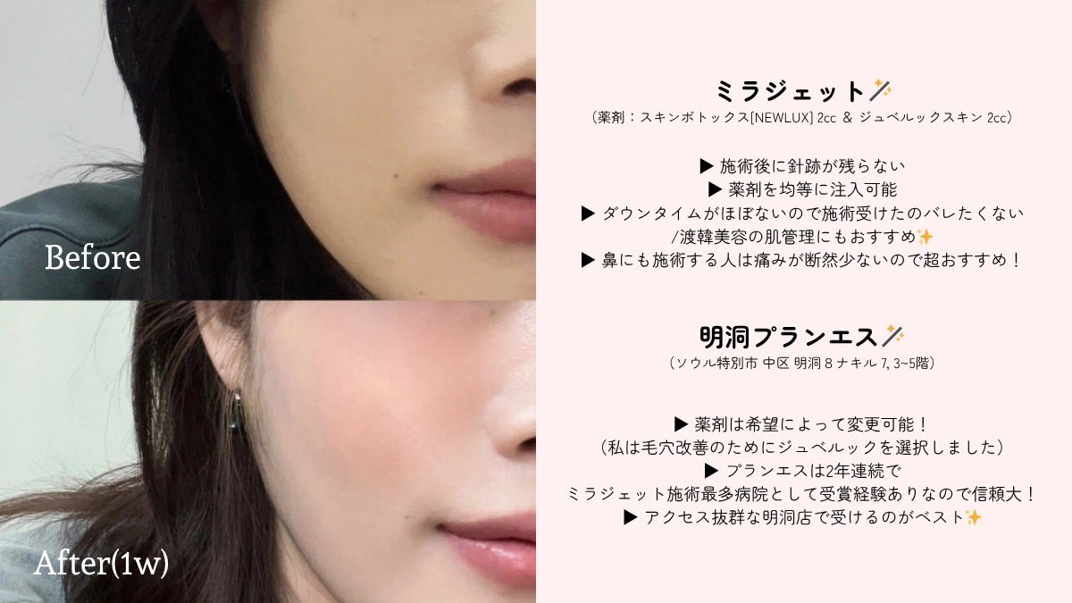 くじら🐳 【社会人in 韓国🇰🇷】 tweet media