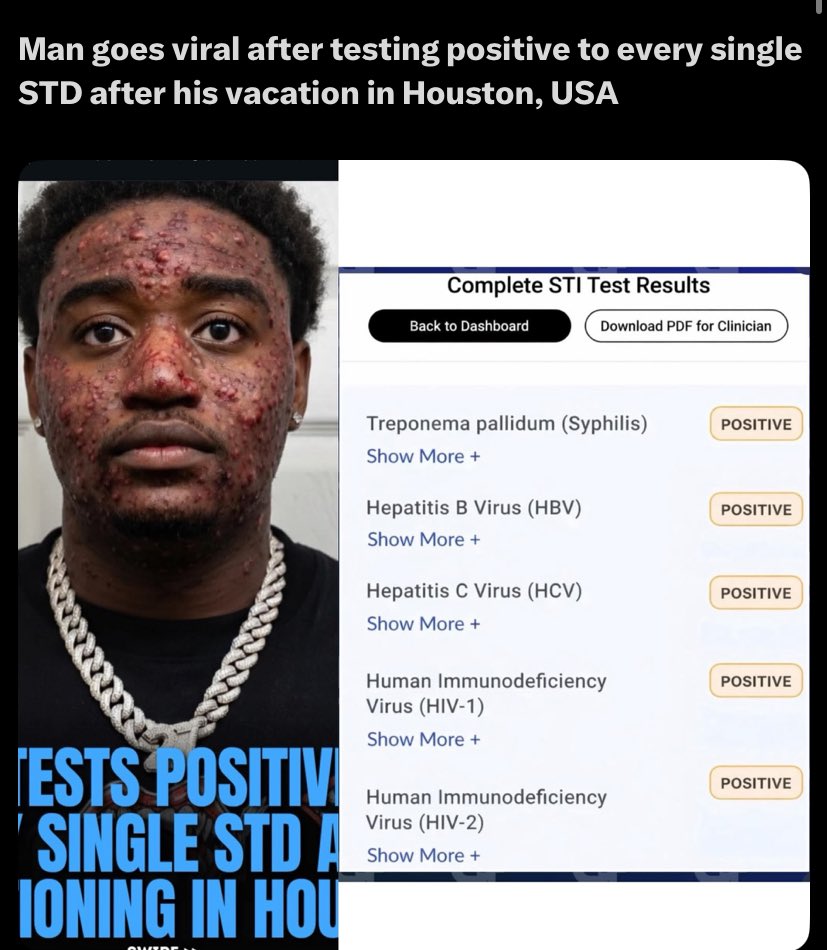 Bhadext🔥PATOA🔥🎤💊 tweet media