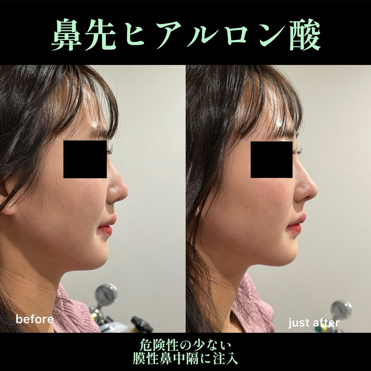 美容外科医さえら tweet media