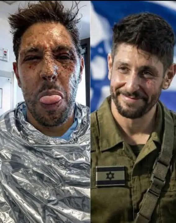 4dr1an 🇾🇪 🇵🇸 tweet media