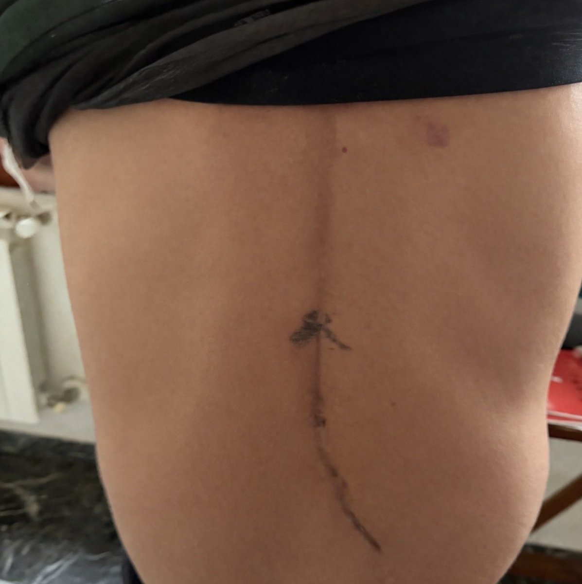 gianluc75235316's tweet image. Entro solo per questo post per tranquillizzare qualche simpatico #novax che ha ironizzato sul mio stato di salute. Il mio è un problema vecchio di cinquant’anni in cui ho chiesto troppo alla mia colonna vertebrale. Dopi 61 mesi e 7 vaccini non ho nessun problema. L’avete nel culo