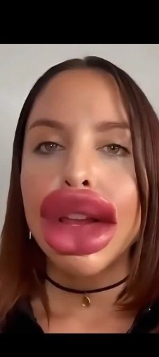 Semi Serio..¯\_(ツ)_/¯ tweet media