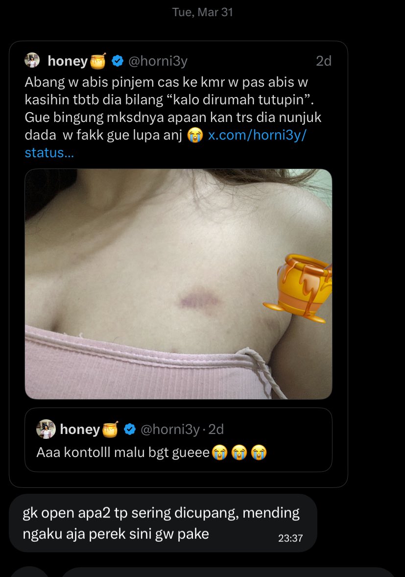 honey🍯 tweet media