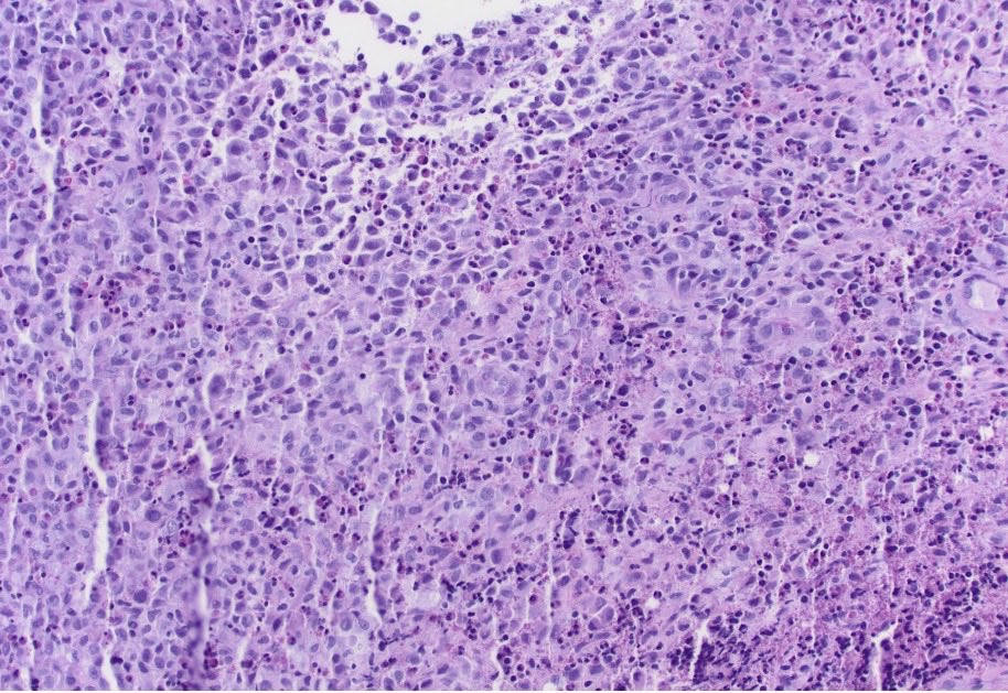 CUpathology tweet media