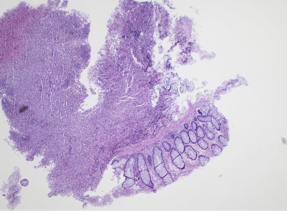 CUpathology tweet media