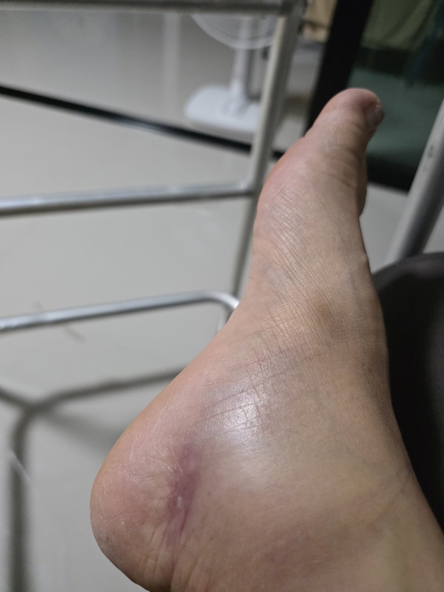 Luck ❤️🖤 tweet media