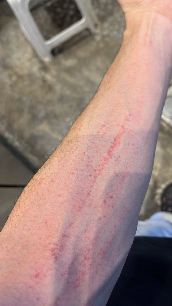 هيرمانوس tweet media