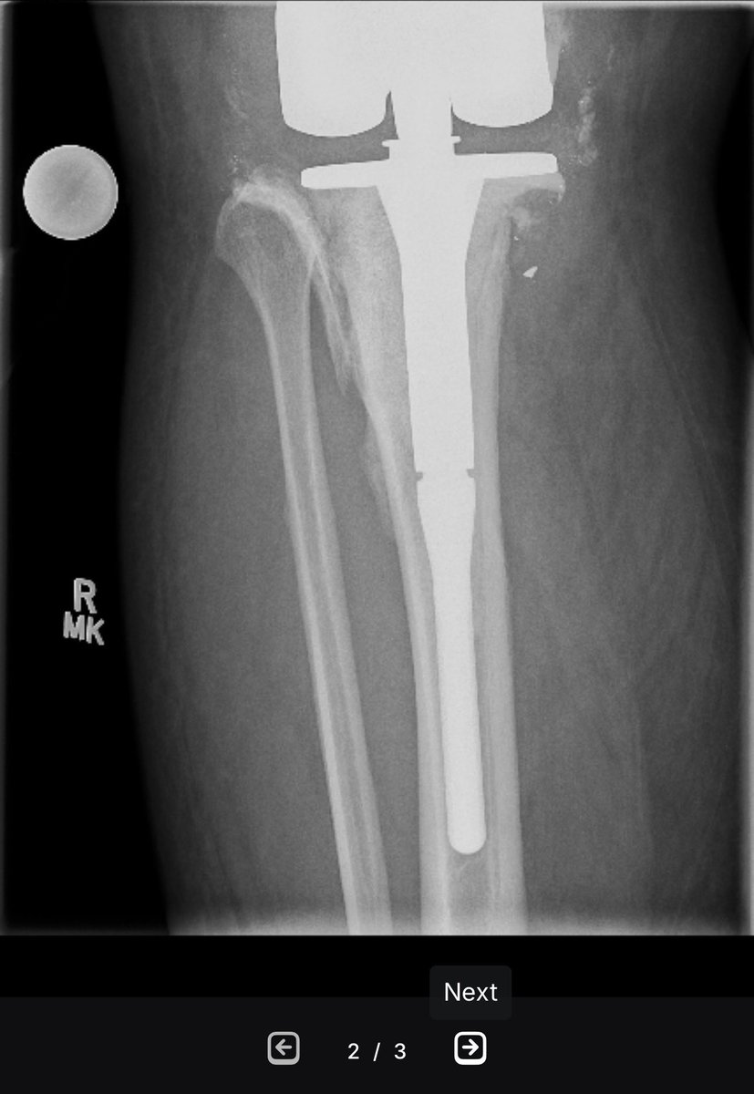 Barry Hunt tweet media