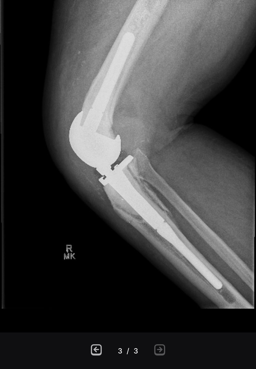 Barry Hunt tweet media