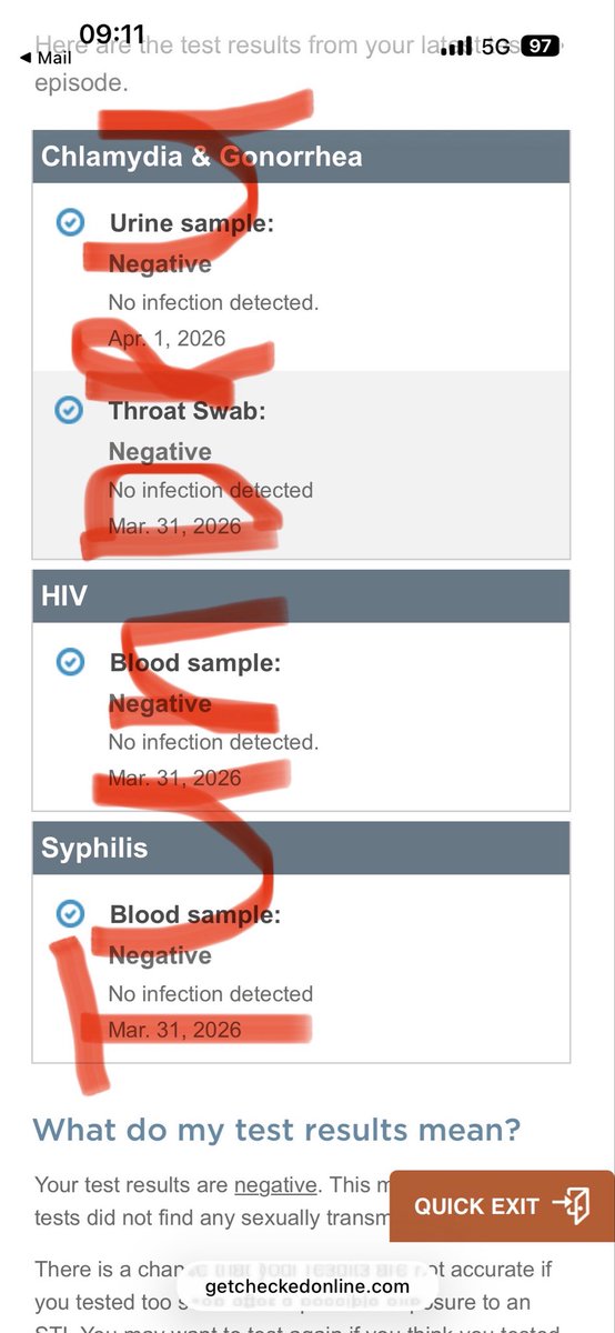Tundru 🔜 LVFC tweet media