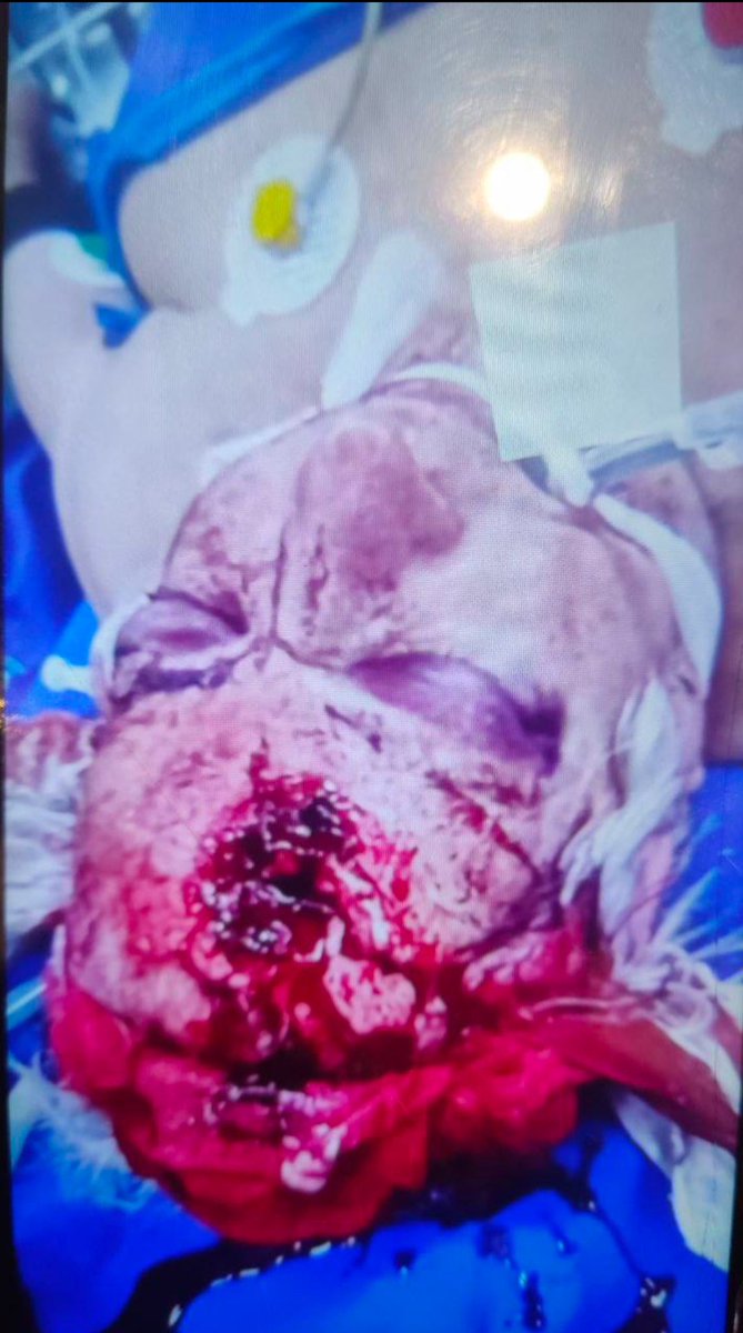 آرماگدون tweet media